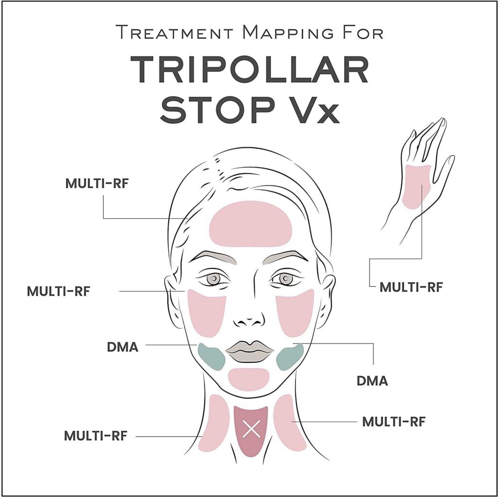 Tripollar Stop Vx